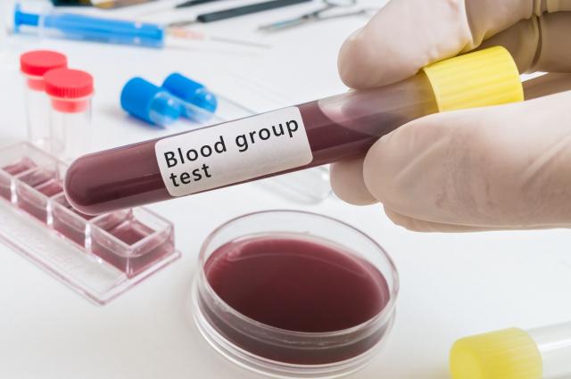 Test krvi predviđa kako ćemo ostariti?