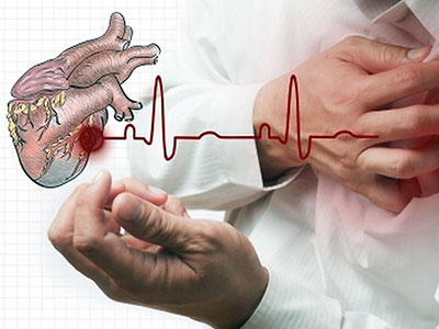 Test krvi predvidjeće opasnost od srčanog udara 15 godina ranije