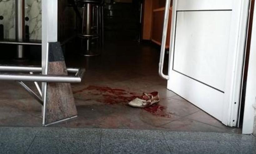 Sin nožem teško ranio majku u kafiću u centru grada