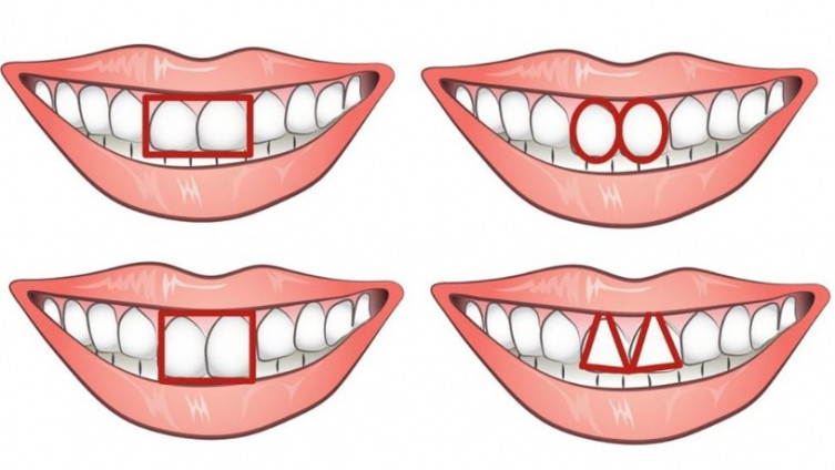 Otkrijte šta oblik vaših zuba govori o vašem karakteru