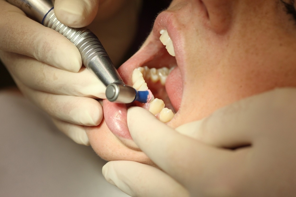 Zubar zapjevao dok je popravljao zub, pacijent zasvirao (VIDEO)