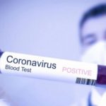 Prva osoba u Srpskoj zaražena virusom korona