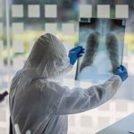 Ovo su trajne posljedice koje ostavlja virus korona