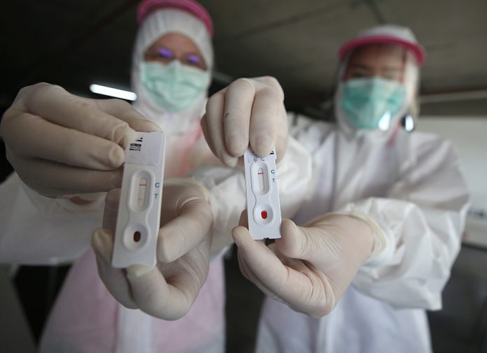 COVID-19 Strip Test in Bangkok