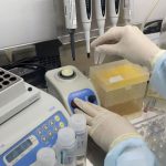 Slovenija: Testiranje na virus korona oko 100 evra