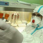 PREMINULA DVA PACIJENTA Korona virusom zaraženo još devet osoba u Republici Srpskoj