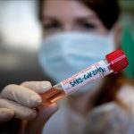 VIRUS PRIJETI Danas u Prijedoru povećan broj zaraženih virusom korona