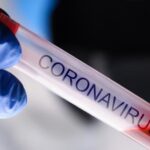 Virus u Srpskoj potvrđen kod 226 osoba, iz Banjaluke čak 103