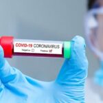 Virus korona potvrđen kod 154 osobe; Preminulo sedam