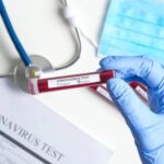 Virus korona potvrđen kod još šest osoba u Srpskoj