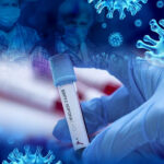Korona virus za tri dana potvrđen kod još 27 ljudi u Srpskoj