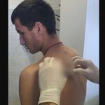 Albanac ga napao nožem: Izbodeni srpski mladić na Kosovu dobio krivičnu prijavu