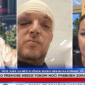 LICE PUNO PODLIVA Prva slika pretučenog Zorana Marjanovića, oko mu je skroz zatvoreno, glava u zavojima